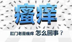 肛門瘙癢治不好嗎？先檢查病因就好辦！